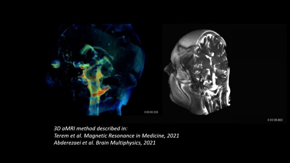 Cerveau en 3D réalisé grâce à l’IRMa 3D | Futura